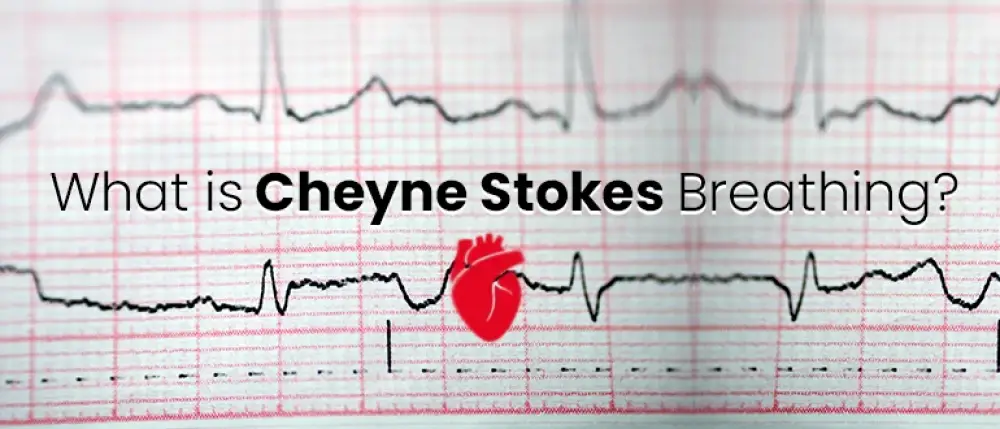 What is Cheyne Stokes Breathing?