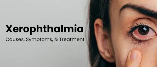 Xerophthalmia: Causes, Symptoms, and Treatment