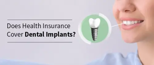 Does Health Insurance Cover Dental Implants?