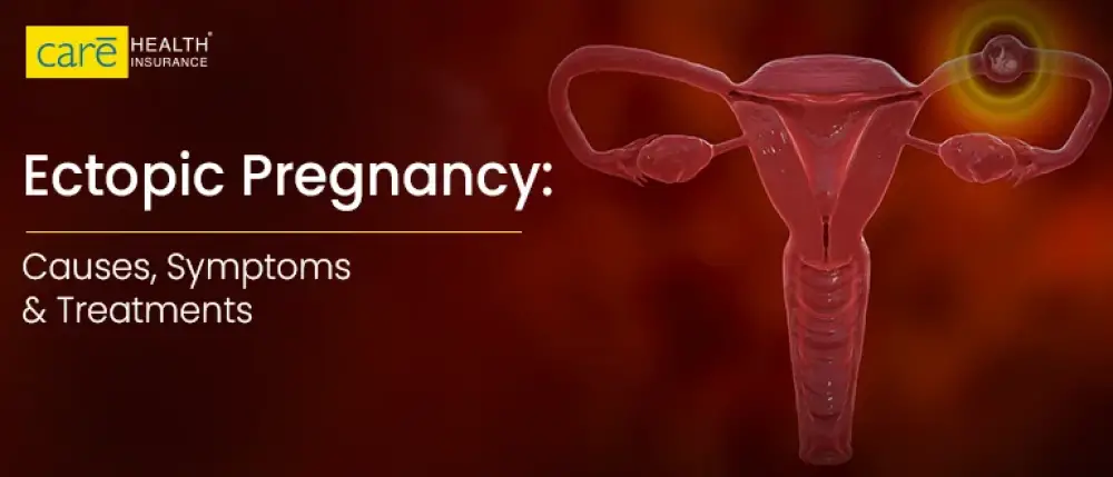 Understanding Ectopic Pregnancy: Causes, Symptoms, and Treatment