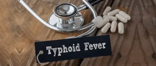 Typhoid - Symptoms, Causes, Treatment & Stages of Typhoid Fever