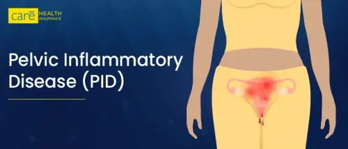 Pelvic Inflammatory Disease (PID): Symptoms, Diagnosis, and Treatments