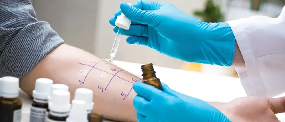 How can Allergy Testing Help in Managing Allergic Reactions?