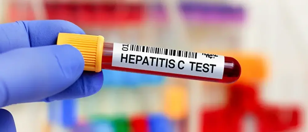 How Deadly is Hepatitis C?